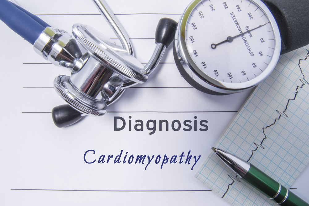 Cardiomyopathy and Fibromyalgia