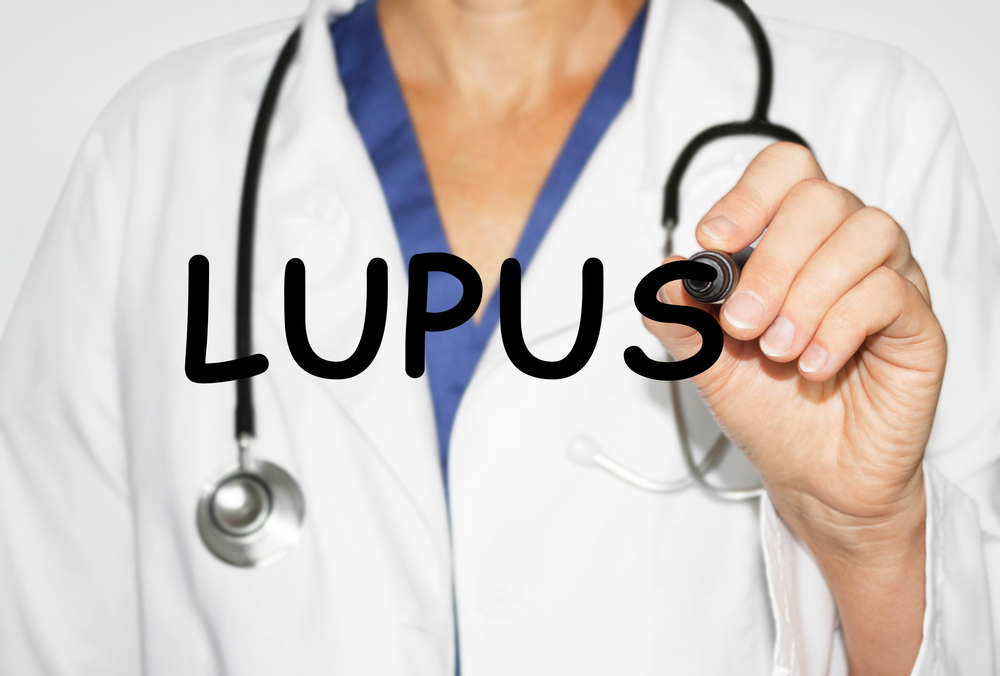 Lupus Erythematosus and Fibromyalgia