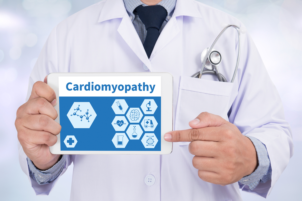 What is Hypertrophic Cardiomyopathy?